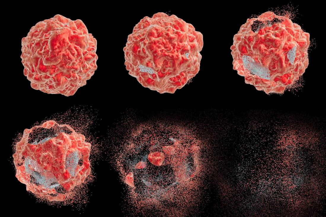 Scientists discover gene therapy trick that makes cancer cells self-destruct