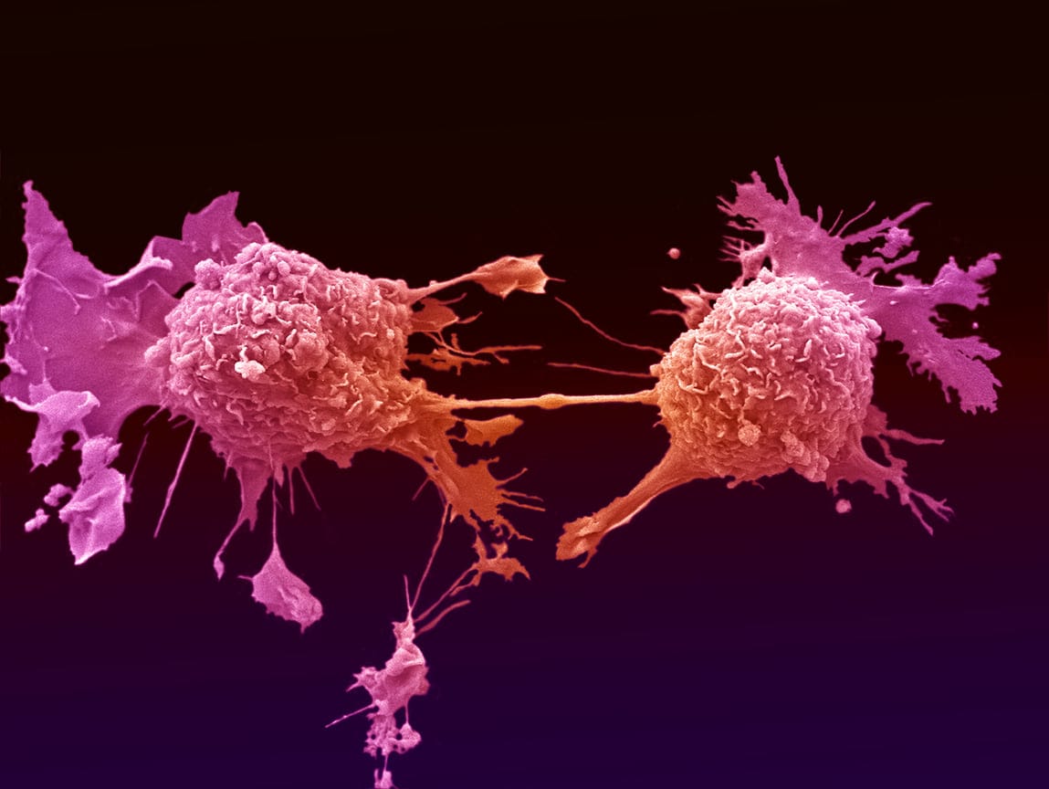 Google is working on AI-enhanced microscope for cancer detection