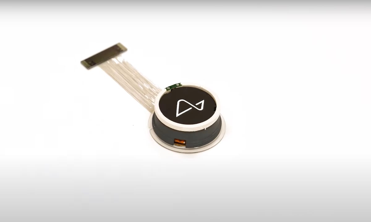Neuralink aims to implant 20,000 brain chips annually and hit $1B in revenue by 2031