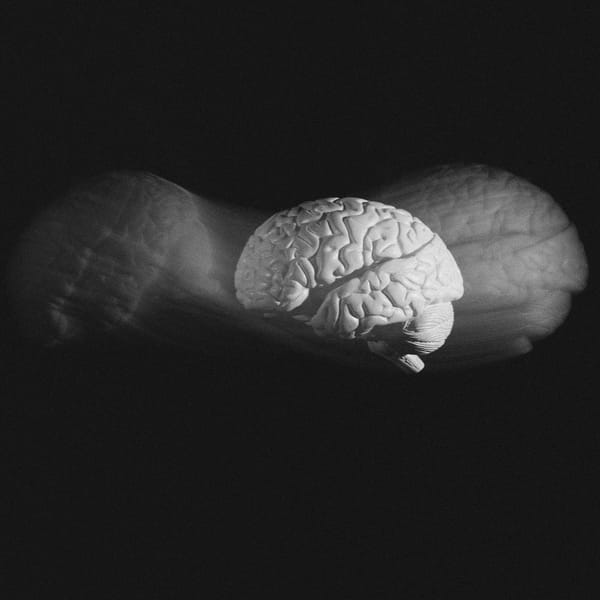 Researcher explores replacing parts of brain with cloned brain tissue to beat aging